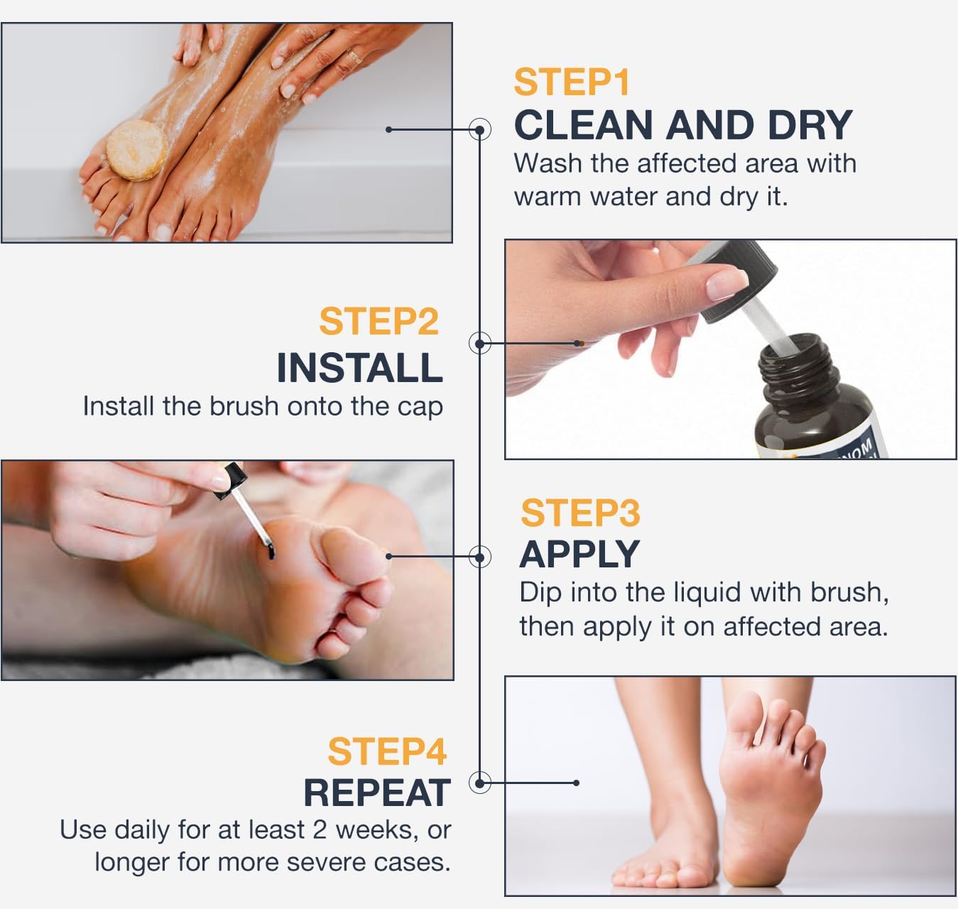 Bee Venom Wart Removal Kit™