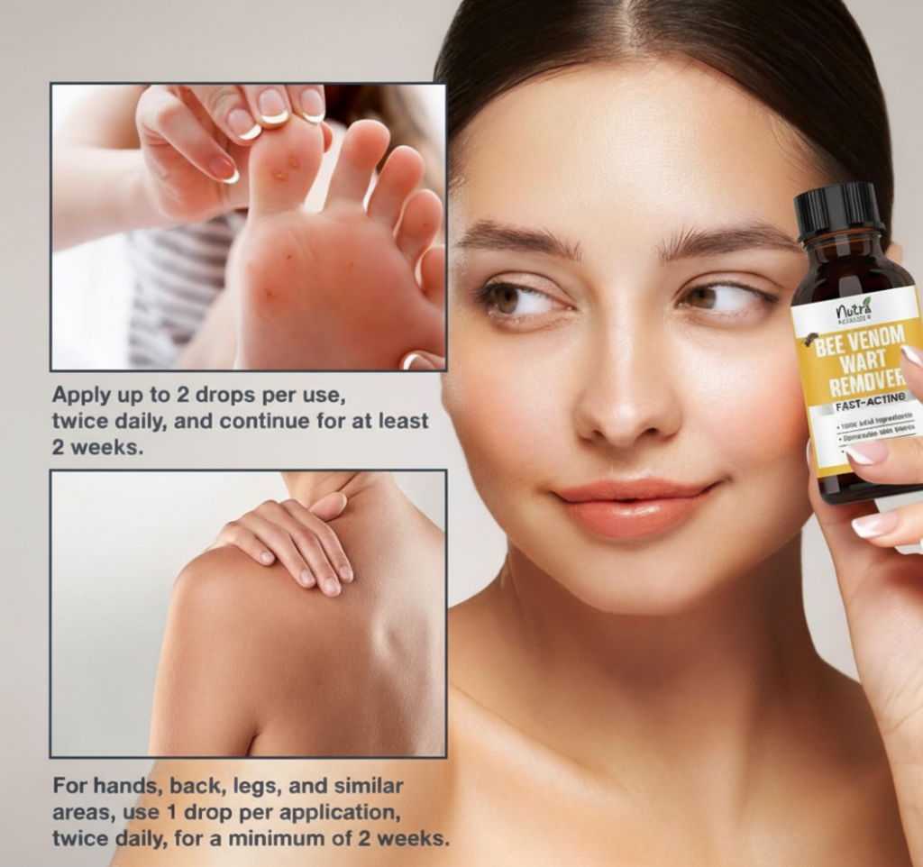Bee Venom Wart Removal Kit™